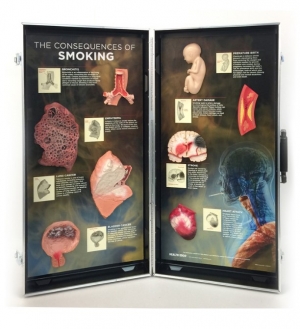 흡연의 결과 3D 디스플레이 / 흡연의 8가지 질병 3D모형 / 금연교육